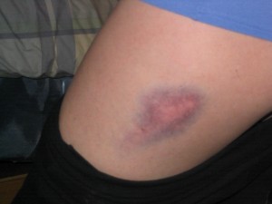 Webshot from coreconcepts.com, Musculoskeletal Group