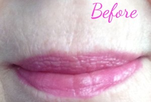 lips-before