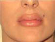 after using Luscious Lips