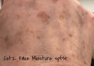 Cotz Lightly Tinted Face Moisture SPF 35 rubbed into the skin on the back of my hand, it's essentially sheer, neversaydiebeauty.com